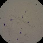 Staphylococcus pseudointermediusによる細菌尿