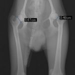 大腿骨頭のX線不透過性亢進像、骨頚部の変形本症例は、膝蓋骨内方脱臼も伴っています。
